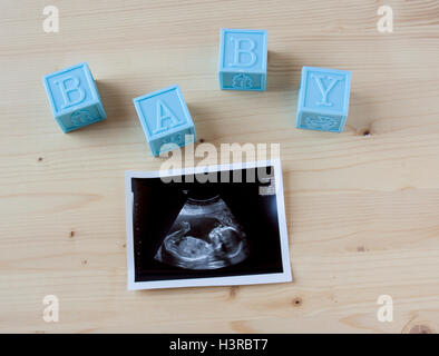 Sonogramm ein kleines Baby auf einem hölzernen Hintergrund. Stockfoto