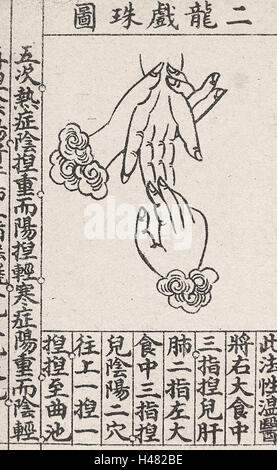 Chinesische medizinische Illustration Trad.. Stil; Handmassage Stockfoto