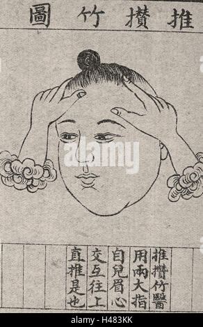 Chinesische medizinische Illustration Trad.. Stil; Gesichtsmassage Stockfoto