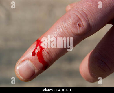 Der Schnitt an seinem Finger, das Blut aus der Wunde gießen Stockfoto