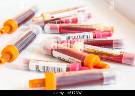 Blutproben im Blutentnahmeröhrchen, probieren Sie Container für die Sammlung und Aufbereitung von Blutproben, barcode Stockfoto