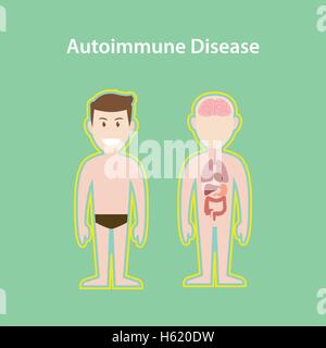 Autoimmunerkrankung-System-Darstellung mit Cartoon Mensch Körper Schutzwirkung Stock Vektor