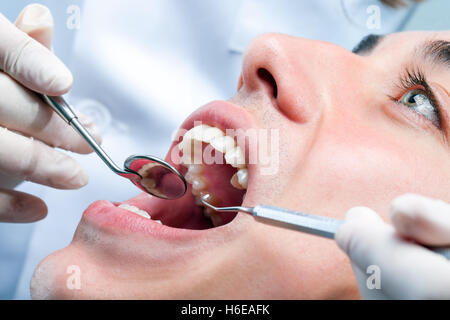 Extreme Nahaufnahme des jungen Mannes mit zahnärztlichen Vorsorgeuntersuchung. Seitenansicht des offenen Mund mit Mundspiegel und dental Beil. Stockfoto