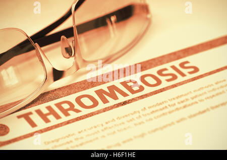 Diagnose - Thrombose. Medizinisches Konzept. 3D Illustration. Stockfoto