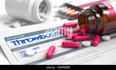 Thrombose - Formulierung in der Anamnese. 3D Illustration. Stockfoto