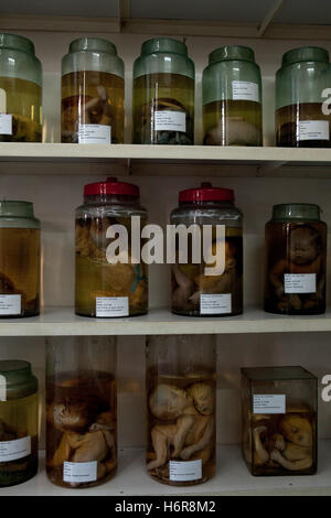 Gläser von Föten mit defekten vor der Exposition gegenüber Agent Orange Dioxin verwendet in den Vietnam-Krieg, Tu tun Krankenhaus Ho Chi Minh Stadt Stockfoto