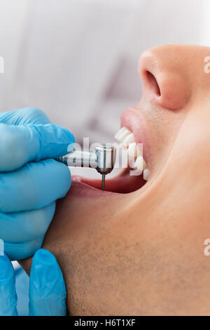 Doktor Arzt Medic medizinische Praktiker Schließ-Tool Gesundheit Detail medizinisch medizinische Closeup Zähne männlichen maskulinen Zahnarzt Stockfoto