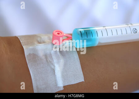 Intravenöse Infusion System. Intravenöse Therapiebehandlung. Stockfoto