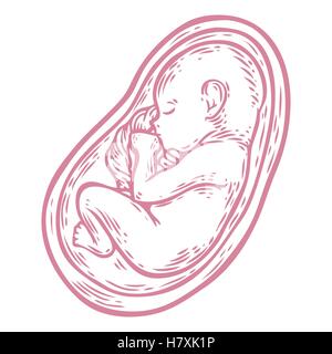 Menschlichen Fötus Konzept Hand gezeichnete Vektor Illustration pränatale wachsendes Baby, Umbilicle Kabel isoliert auf einem weißen Hintergrund als ein ob Stock Vektor