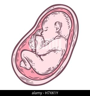 Menschlichen Fötus Konzept Hand gezeichnete Vektor Illustration pränatale wachsendes Baby, Umbilicle Kabel isoliert auf einem weißen Hintergrund als ein ob Stock Vektor