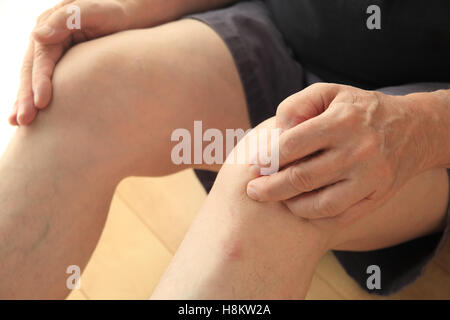 Ein älterer Mann sitzt auf dem Boden mit den Händen auf die Knie schmerzhaft. Stockfoto