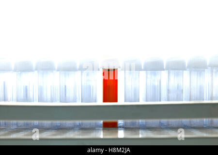 Blut Test Probenröhrchen Stockfoto