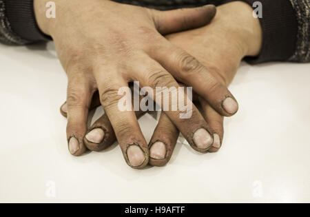 Hände des Mannes mit Fett und Schmutz, befleckt arbeiten Stockfoto