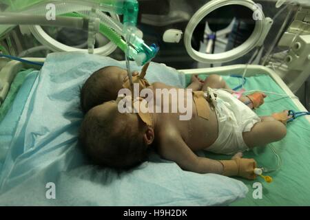 Gaza-Stadt, Gazastreifen, Palästinensische Gebiete. 23. November 2016. Ein-Tag-alte palästinensische siamesischen Zwillingen liegen in einem Inkubator in der Gärtnerei am al-Shifa Hospital in Gaza-Stadt am 23. November 2016 Credit: Ashraf Amra/APA Bilder/ZUMA Draht/Alamy Live News Stockfoto