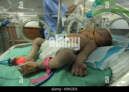 Gaza-Stadt, Gazastreifen, Palästinensische Gebiete. 23. November 2016. Ein-Tag-alte palästinensische siamesischen Zwillingen liegen in einem Inkubator in der Gärtnerei am al-Shifa Hospital in Gaza-Stadt am 23. November 2016 Credit: Ashraf Amra/APA Bilder/ZUMA Draht/Alamy Live News Stockfoto