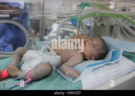 Gaza. 23. November 2016. Ein-Tag-alte palästinensische siamesischen Zwillingen liegen in einem Inkubator in der Gärtnerei am 23. November 2016 im al-Shifa Hospital in Gaza-Stadt. © Wissam Nassar/Xinhua/Alamy Live-Nachrichten Stockfoto