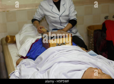 Moxibustion-Therapie-Szene Stockfoto