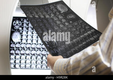 Arzt hält ein Bild eines Gehirns MRI-Workflows Stockfoto