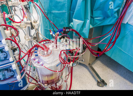 Herz-Lungen Maschine Herzklappe Ersatz Chirurgie, OP-Saal, Reykjavik, Island Stockfoto