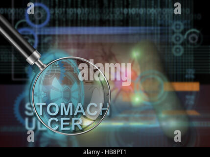 Magengeschwür Stockfoto