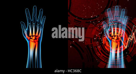 3D gerenderten Anatomie-Illustration - Hand-Schmerzen Stockfoto