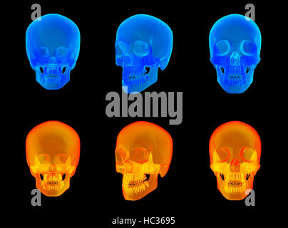 3D Rendering des X-Ray menschlicher Schädel Stockfoto