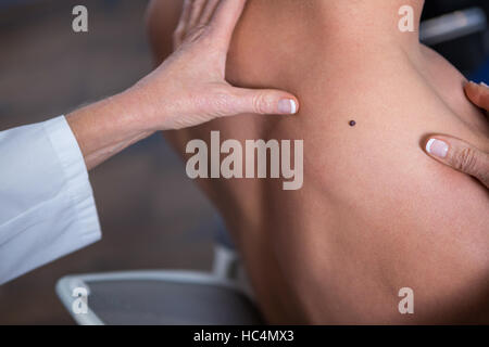 Hautarzt untersuchen Mol des Patienten Stockfoto