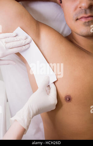 Arzt wachsen männliche Haut des Patienten in der Klinik Stockfoto