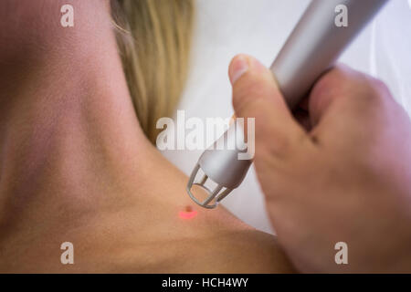 Hautarzt entfernen Maulwurf aus Womans Schulter Stockfoto