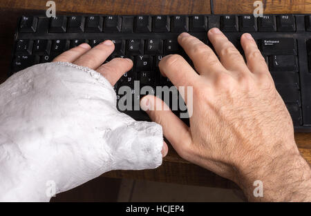 Junge Mann trägt einen Gipsarm nach dem Bruch seines Handgelenks Schwierigkeiten auf einer Computertastatur tippen Stockfoto