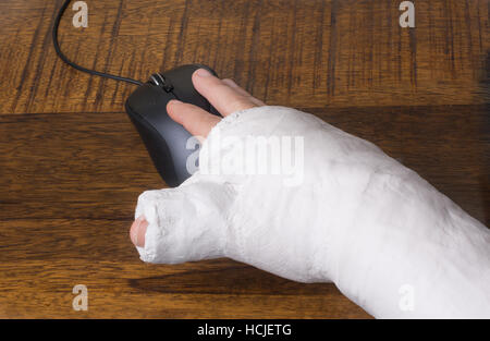 Eine Person trägt einen Gipsarm nach der Trennung von ihrem Handgelenk Schwierigkeiten mit einer Computermaus Stockfoto