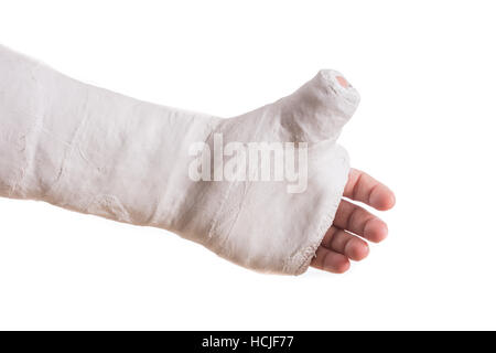 Nahaufnahme von einem weißen Arm Pflaster / Fiberglas gegossen mit dem Daumen in ein Daumen-hoch-Form, isoliert auf weiss erweitert Stockfoto