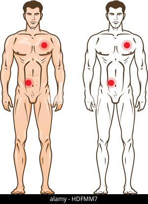 Mann-Silhouette mit Schwachstellen. Medizin-Infografik. Vektor-Illustration isoliert auf weißem Hintergrund Stock Vektor