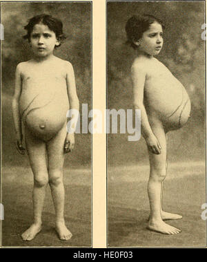 Moderne Diagnostik und Behandlung von Erkrankungen der Kinder; eine Abhandlung über die medizinischen und chirurgischen Erkrankungen in der Kindheit anf Kindheit (1911) Stockfoto