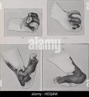 Transaktionen der American Association of Geburtshelfer und Gynäkologen Abdominal-Chirurgen für das Jahr (1920) Stockfoto