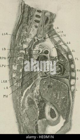 *Erkrankungen der Brust und die Prinzipien der körperlichen Diagnose* (1920) bietet eine detaillierte Studie der Brusterkrankungen, wobei der Schwerpunkt auf den von Ärzten verwendeten Diagnosetechniken liegt. Es umfasst sowohl häufige als auch seltene Erkrankungen, die den Brustkorb betreffen, und die Methoden, mit denen sie diagnostiziert werden. Stockfoto