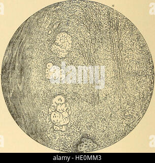 Diese Abhandlung von 1897 bietet eine detaillierte Anleitung zur Diagnose und Behandlung von Hautkrankheiten, die sich an Studenten und Ärzte in der Dermatologie richtet. Stockfoto