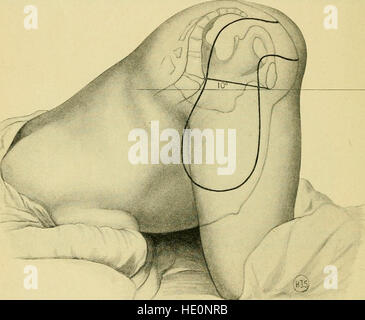 Die Praxis der Geburtshilfe, konzipiert für den Einsatz von Studenten und Praktiker der Medizin (1910) Stockfoto