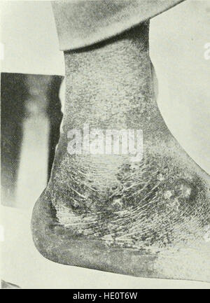 Diese Zeitschrift 1921 konzentriert sich auf die Erforschung tropischer Krankheiten, die öffentliche Gesundheit in tropischen Regionen und medizinische Forschung im Zusammenhang mit tropischen Klimazonen und ihren Auswirkungen auf die menschliche Gesundheit. Stockfoto