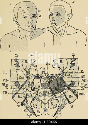 Krankheiten des Nervensystems - ein Lehrbuch für Neurologie und Psychiatrie (1915) Stockfoto