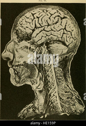 Eine Abhandlung über die nervösen und psychischen Erkrankungen, für Studenten und Praktiker der Medizin (1893) Stockfoto