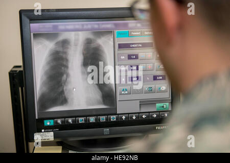 US Air Force Airman 1st Class Jason Grosso, diagnostische Bildgebung Technologe mit der 35. chirurgische Operations Squadron, führt Nachbearbeitung Operationen der Brust des Patienten Röntgen in Misawa Air Base, Japan, 27. Januar 2016. Grosso stellt Ton und Farbe Parameter, um die richtige Menge an grau zu bekommen, so dass Ärzte Verletzungen diagnostiziert werden können. Je heller eine Fläche auftaucht, der mehr Strahlung wird absorbiert. Dieser Prozess stellt sicher, dass jedes Bild von den Ärzten leicht interpretierbar ist. Grosso stammt aus Bridgman, Michigan.  Staff Sgt. Benjamin W. Stratton) Stockfoto