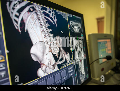 US Air Force Airman 1st Class Samantha Bradford, diagnostische Bildgebung Technologe mit der 35. chirurgische Operations Squadron, analysiert Knochenstruktur des Patienten nach Durchführung eines Computertomographie-Scans bei Misawa Air Base, Japan, 27. Januar 2016. Mit diesen Maschinen sagte Bradford sie 3-d-Rekonstruktionen oder digitale Scheiben des Körpers, aus den Knochen des Patienten Elemente so klein wie Blutgefäße sehen können. Wenn ein paar Sekunden den Unterschied zwischen Leben und Tod bedeuten könnte, erleichtert diese Scans, fast alles zu sehen gibt es über den Patienten wissen. Bradford ist ein Korinth, Mai Stockfoto