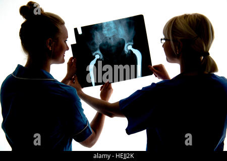 UK Health Care Professionals: A National Health Service (NHS) weibliche Ärztin und Krankenschwester, Blick auf eine Reihe von Röntgenbildern einer doppelten Hüftgelenkersatz-Operation Stockfoto