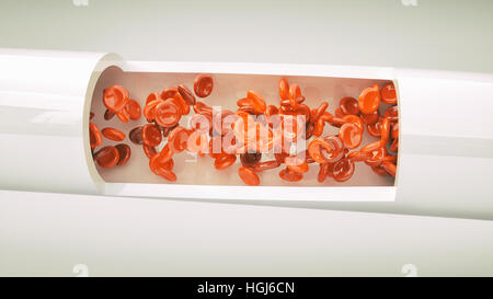 Schnitt durch eine Arterie - 3D Rendering Stockfoto