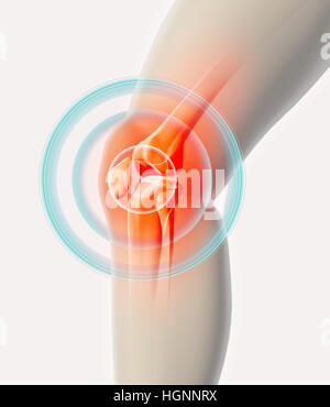 Knie Schmerzen - Skelett Röntgen, 3D Illustration medizinisches Konzept. Stockfoto