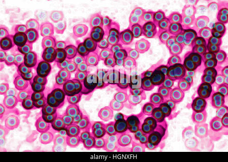 STREPTOCOCCUS PYOGENES Stockfoto