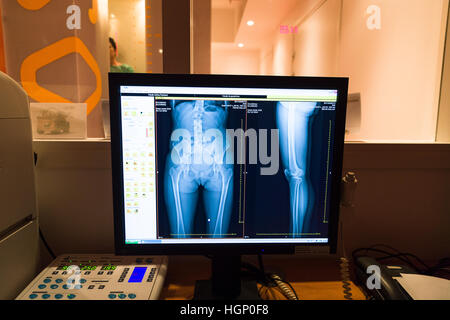 EOS X-RAY IMAGING Stockfoto