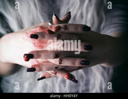 Junge Frau Hand mit Blut und Marienkäfer Stockfoto