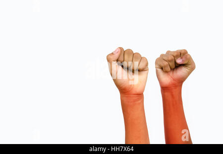 Verletzungen der Hand von Kindern für den Sieg auf weißem Hintergrund Stockfoto